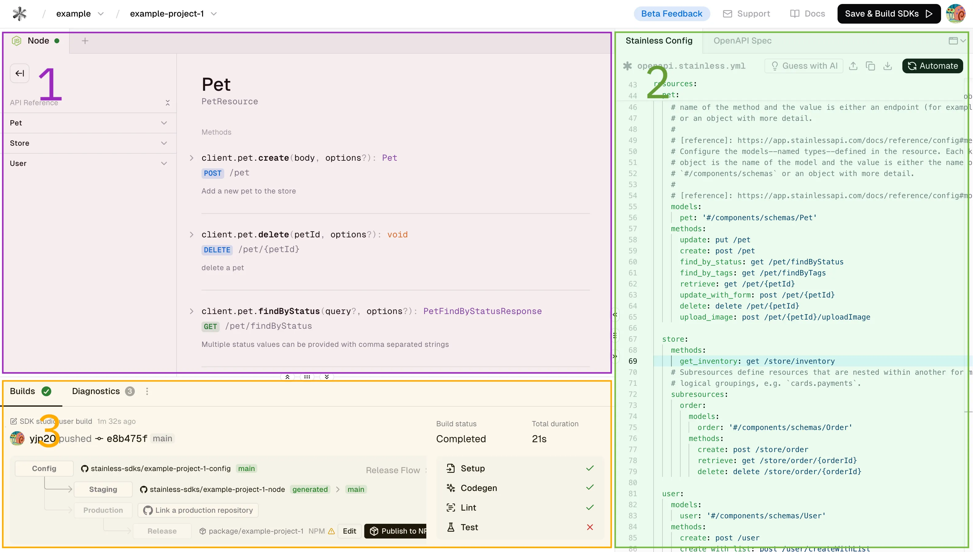 The Stainless Studio showing the SDK preview, editor, and builds panes